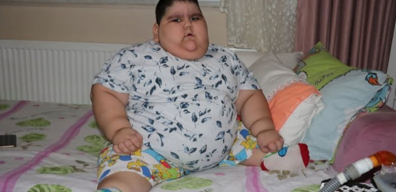 4 yaşında 70 kiloya ulaşan Yağız, yardım bekliyor