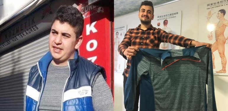 Akupunkturla tam 40 kilo verdi