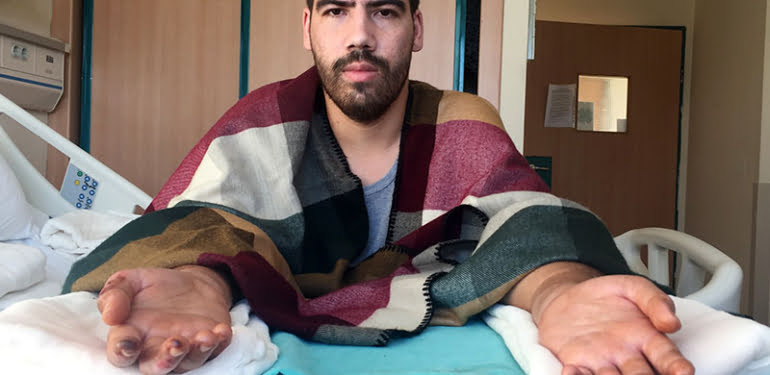 Çift kol nakilli Yusuf Oğuz’un tırnakları uzamaya başladı