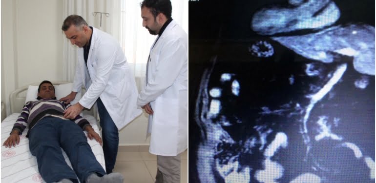 Doktorlar hastayı muayene edince şok oldu