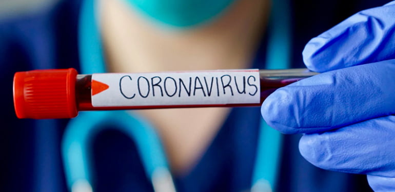 coronavirus-koronavirus-kovid-hSeM_cover