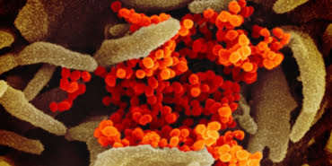 covid-19un-koronavirus-fotograflari-yayimlandi_3060_dhaphoto3