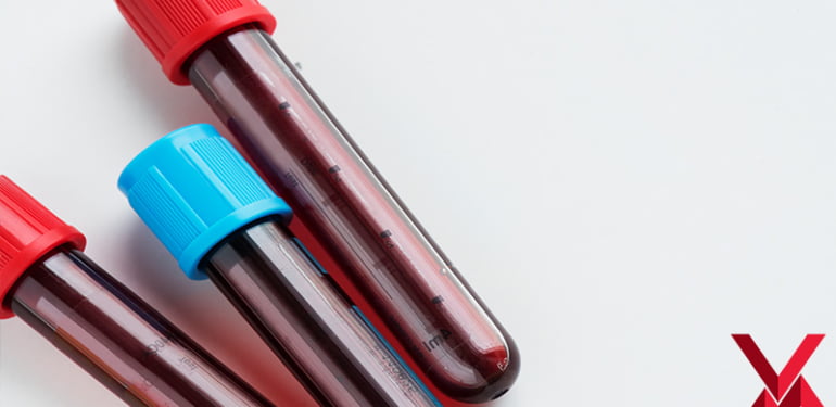 HGB (Hemoglabin) Nedir ? Hemoglabin Düşüklüğü ve Yükseliği Ne Anlama Gelir ?