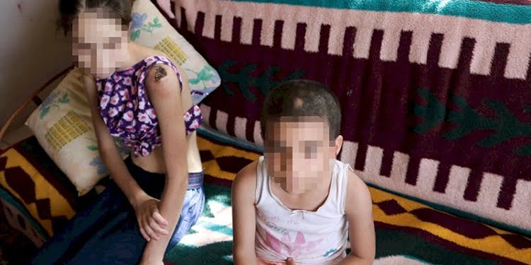 Üvey babadan abla kardeşe keser saplı işkence