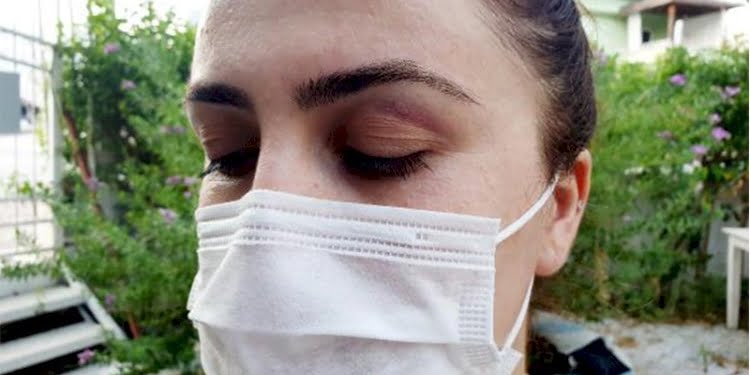 Hemşire, maske takmalarını istediği turistlerin terlikli saldırısına uğradı