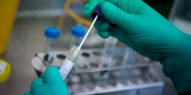 İki test aynı anda yapılabilecek
