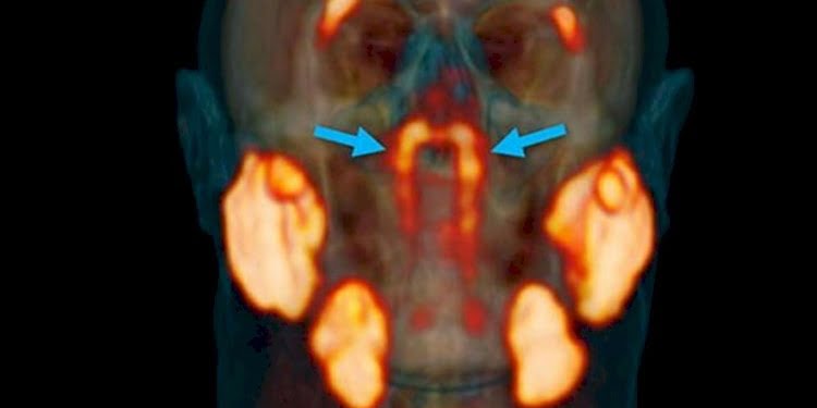 Kafatasında yeni bir organ buldu
