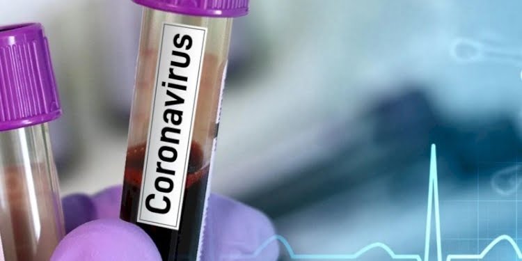 Bakanlık vatandaşlardan gelen Kovid-19 sorularını açıkladı
