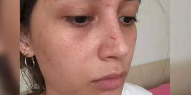20 yaşındaki genç kadını şort giydiği için darp eden 71 yaşındaki adamdan skandal savunma