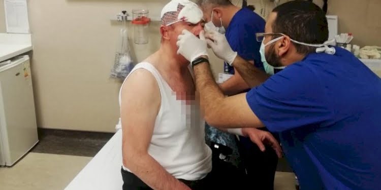 Saldırıya uğraya Selçuk Özdağ’dan ‘organize örgüt’ iddiası