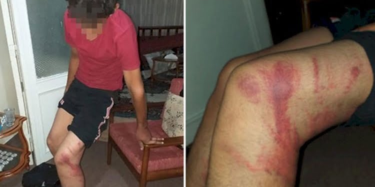 Ustanın çırağını dövdüğü triger kayışı, ‘silah’ sayıldı: Cezası belli oldu