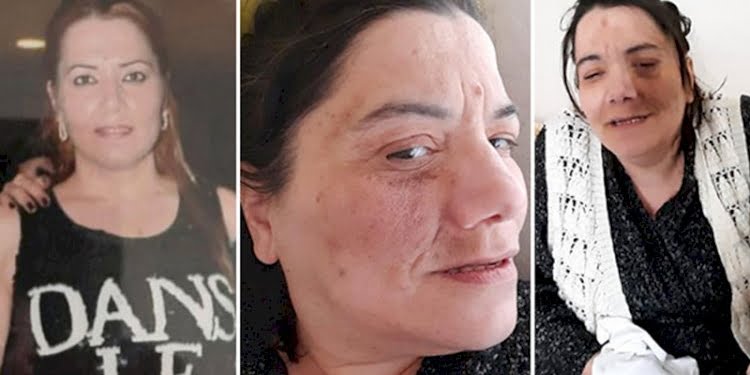 Dişçiye gitti, yüz felci oldu!