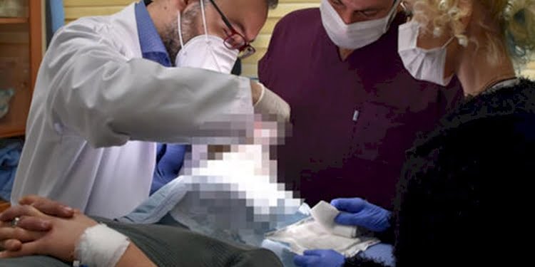 Türkiye’de bir üniversitede daha yüz nakli yapılacak