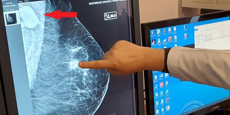 Aşılama arttıkça 50 yaş üzeri kadınlarda sıkça rastlanmaya başladı! Uzmanından önemli uyarı
