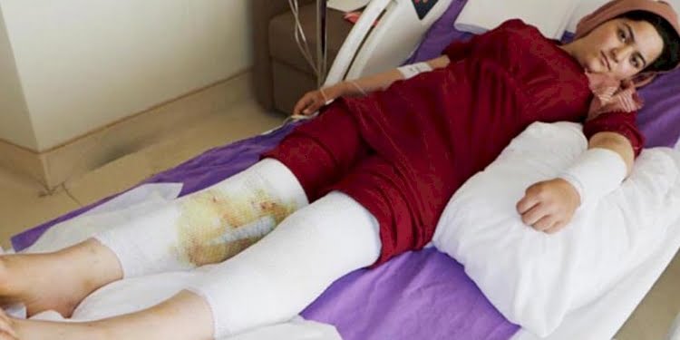 Bomba gibi patlayan düdüklü tencere hastanelik etti