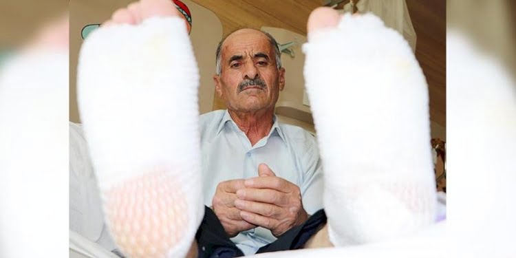 Elektrik akımına kapılınca ayak tabanları patladı