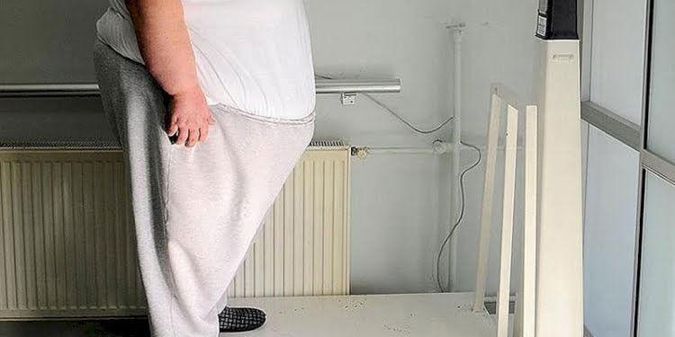 Obezite hastalarına çok önemli koronavirüs uyarısı