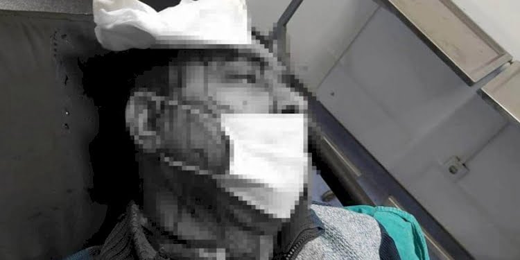 İmam tabureyle müzezzinin kafasını kırdı