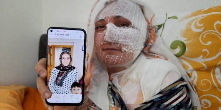 Kızgın yağ döktü, tencereyle dövdü, ‘sen neden ölmüyorsun’ diye bağırdı… ‘Çıkarsa kesin beni öldürür!’