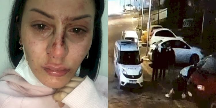 Polislerin dövdüğü kadına emniyet müdürü çiçek yolladı