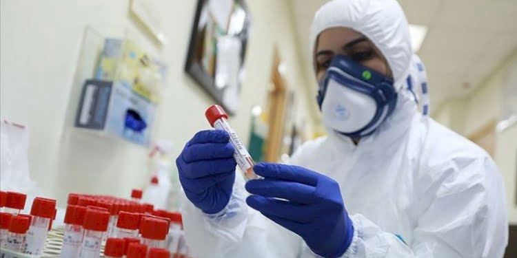 ABD kendi laboratuvarlarını ne zaman açacak?
