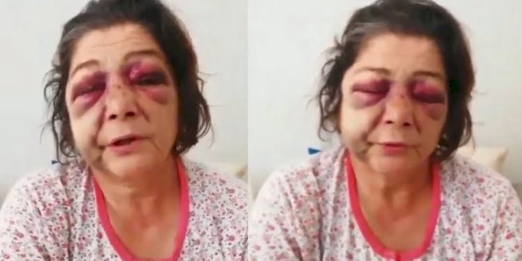‘Belediye başkanının adamları kadını dövdü’ iddiasına CHP’den açıklama