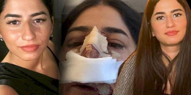 Hayatını kabusa çevirdi: ‘Bunlar da sana düğün hediyem olsun’ dedi