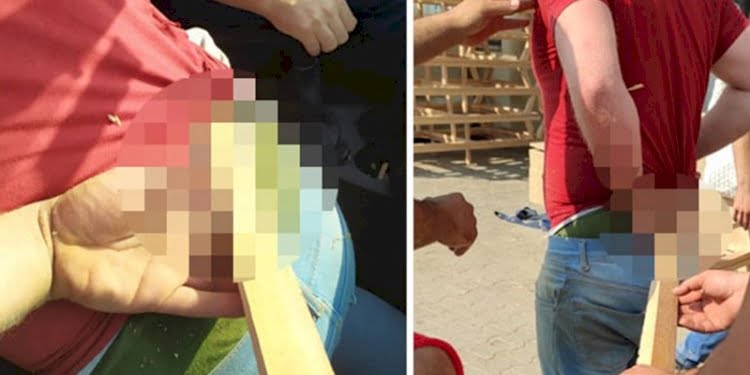 Görünmez kazanın böylesi: Fırlayan kereste beline saplandı
