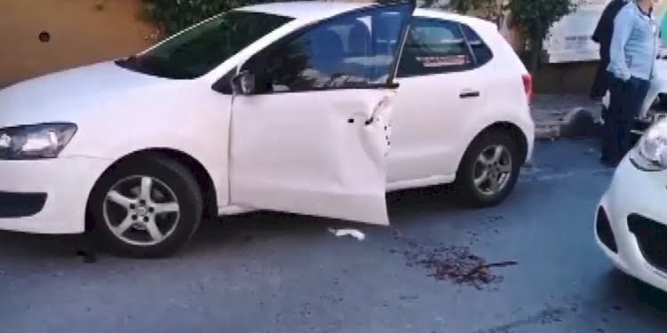 Beyin cerrahının kazada parmakları koptu: Koşarak acile gitti