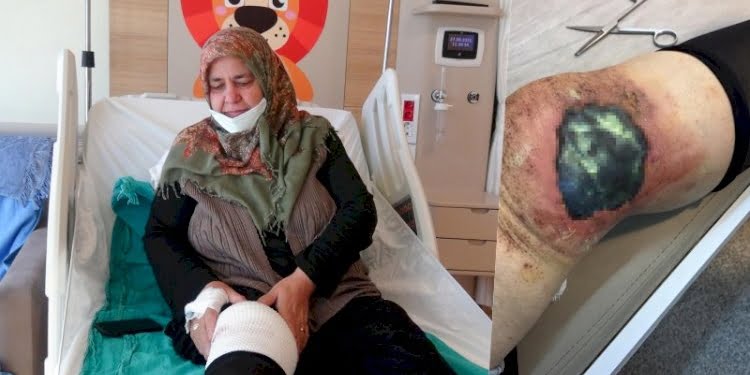 ‘Bitkisel tedavi’ dizini yaktı