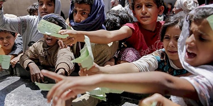 Yemen’de çocuklar açlıkla boğuşuyor