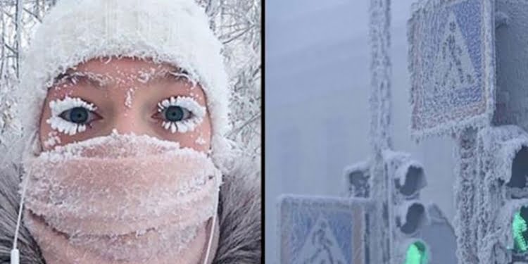 -40 derecede mini etekle sokağa çıkan genç kız, eve geldiğinde bacağını görünce çığlık attı