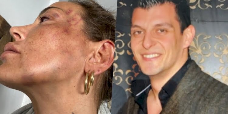 Darbedilen kadın: Yardım istedim, ‘aracı hazırlayın’ diyen bir ses duydum
