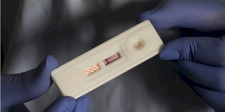‘Kovid’den farkı yok’… AIDS yayılıyor!