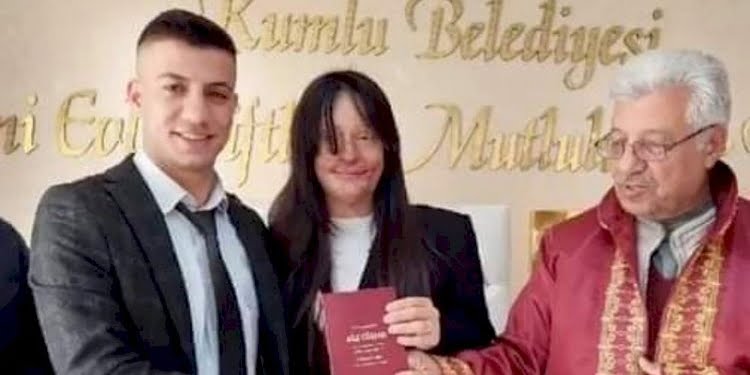 Yüzüne asitli saldırı yapılan Berfin Özek’ten şaşırtan evlilik kararı