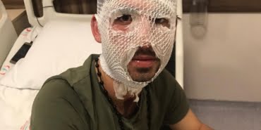 Yunan sınır polisinin sığınmacıyı kaynar suyla yaraladığı iddiası