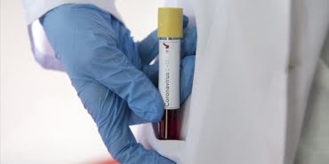 koronavirus-5