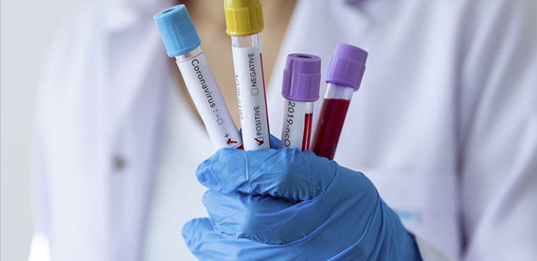 koronavirus-5