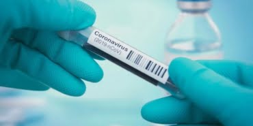 koronavirus-7