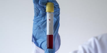 koronavirus-ab-kurumlarin-548_2-41