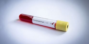koronavirus-avustralya-da-can-aldi