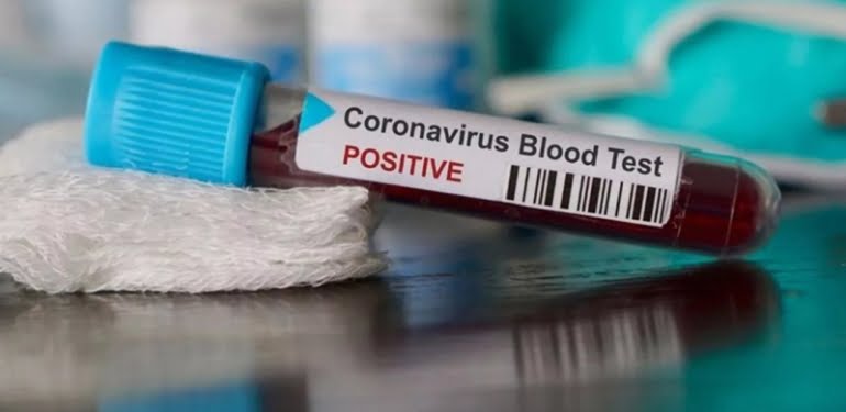 Erkeklik hormonunun koronavirüsten koruyabileceği iddia edildi