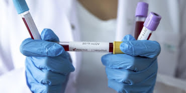 koronavirus13-060320201583489089edc2540e-1