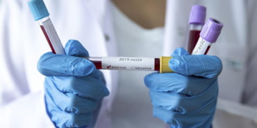 koronavirus13-060320201583489089edc2540e