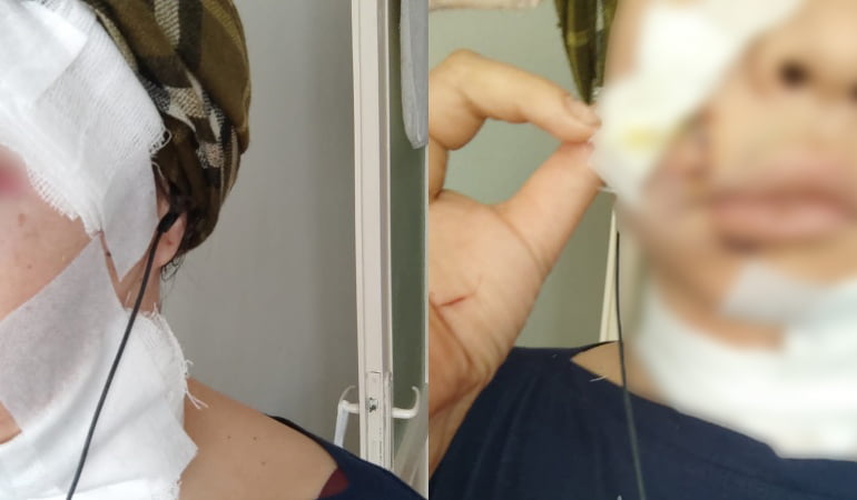 Kadın boynu kesilmiş halde bulundu! Şüpheli serbest kaldı