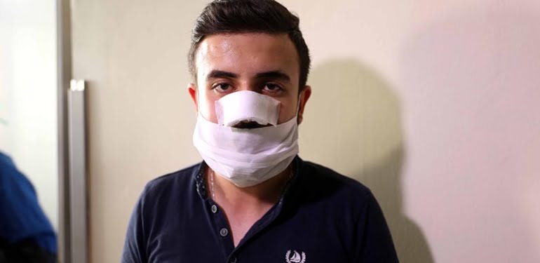 Koronavirüs servisinde görevli sağlık çalışanının burnunu kırdılar!