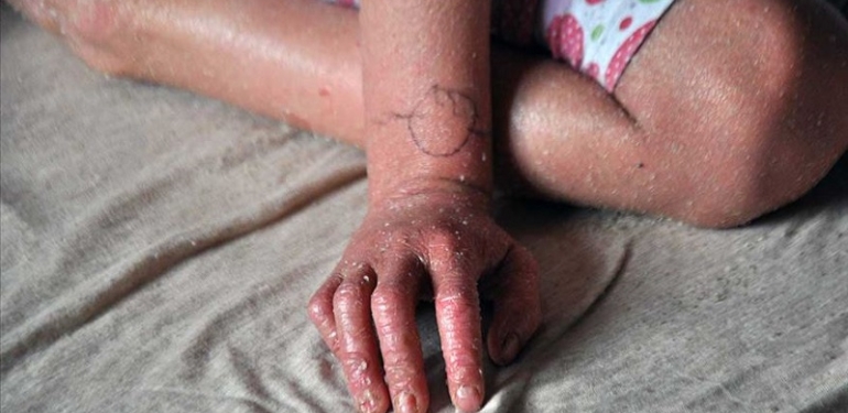 thumbs_b_c_337275d8dd133856f5ae35756958ca46