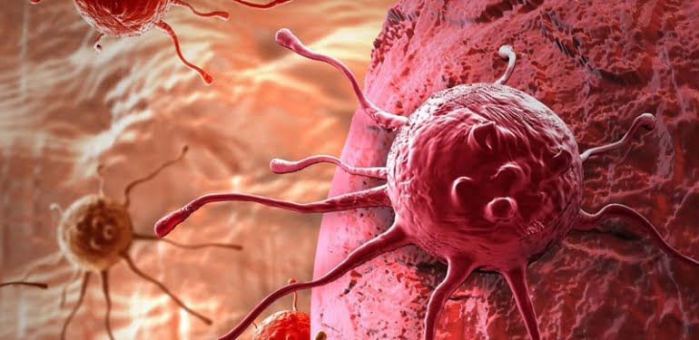 ‘Yamyam’ kanser hücreleri kemoterapi sonrası geri dönüyor