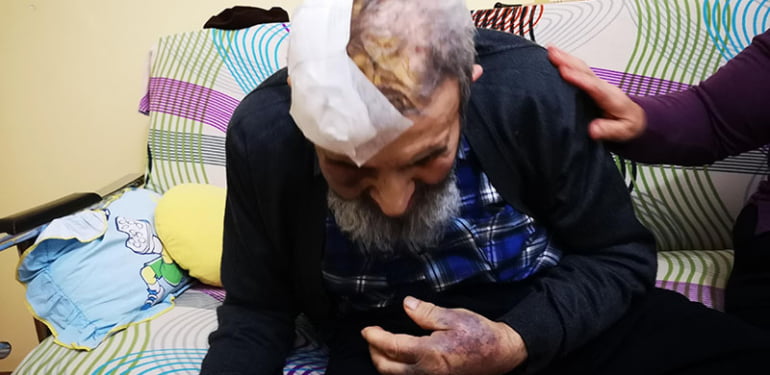 93 yaşındaki adamı dövüp gasp ettiler