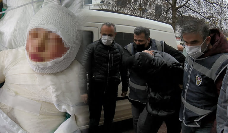 Ateşe verdiği kadını yanarken izlemiş